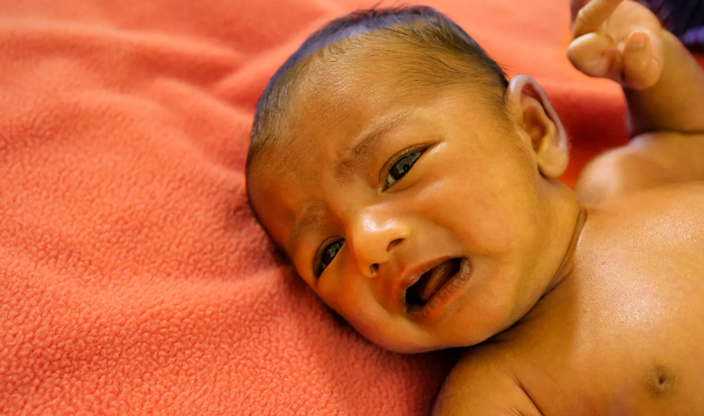 How does jaundice affect children?