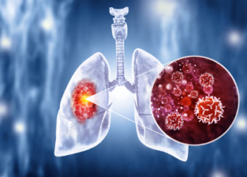 A healthy lifestyle is the first step against cancer