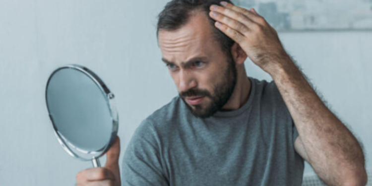 Is there a link between hair loss in men and stomach health?