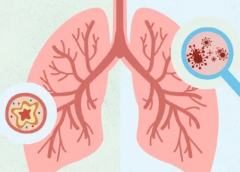 ವಯಸ್ಕರಲ್ಲಿ ಅಸ್ತಮಾ ಅಪಾಯ ಕಡಿಮೆ ಮಾಡಬಹುದೇ? ಅಧ್ಯಯನ ಏನು ಹೇಳುತ್ತದೆ ?