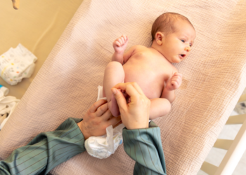 Caution when using diapers for children: Doctors' advice
