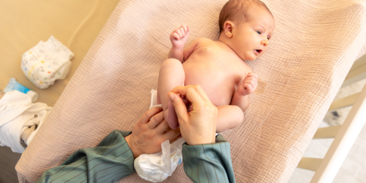 Caution when using diapers for children: Doctors' advice